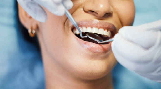 Best Emergency Dental Care for Abscessed Tooth in Oakmont, PA